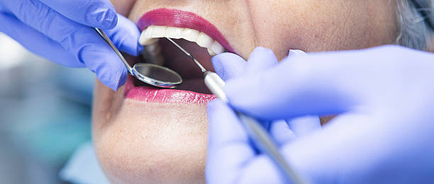 Best Emergency Denture Repair in Milford City, CT